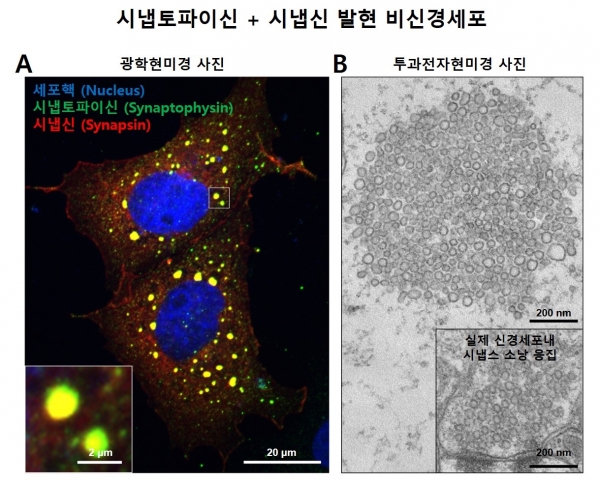 시냅토파이신과 시냅신에 의한 액체-액체 상분리 현상 및 비신경세포에서의 시냅스소낭 응집 모사 구조 형성